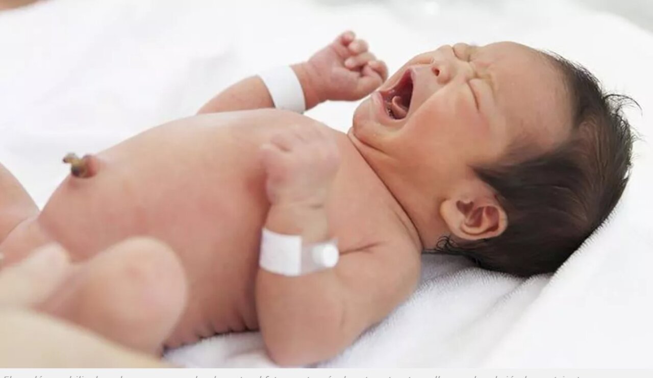 cordon umbilical