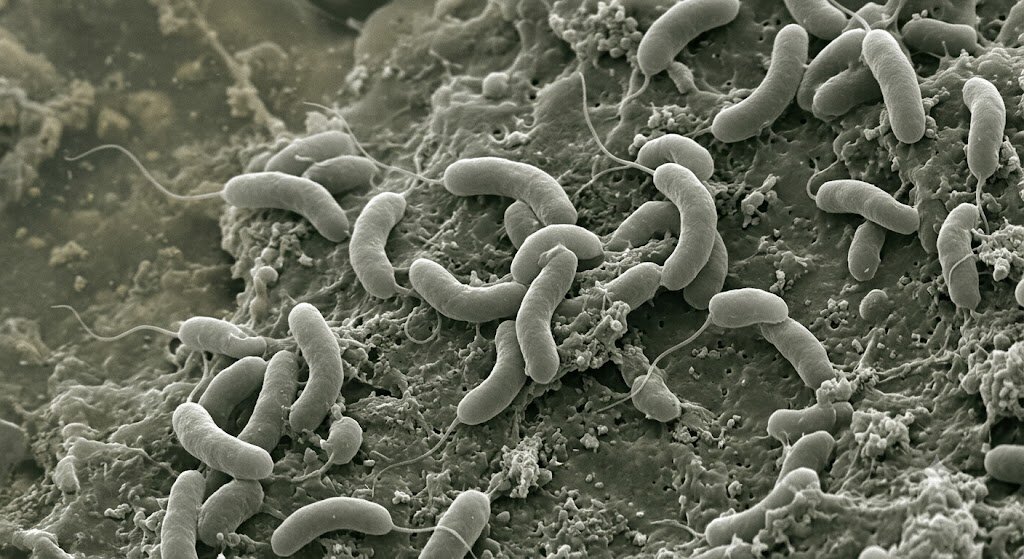 Muere una persona por bacteria come carne en Florida; hay 11 contagiados Representación de Vibrio vulnificus una de las llamadas bacteria come carne